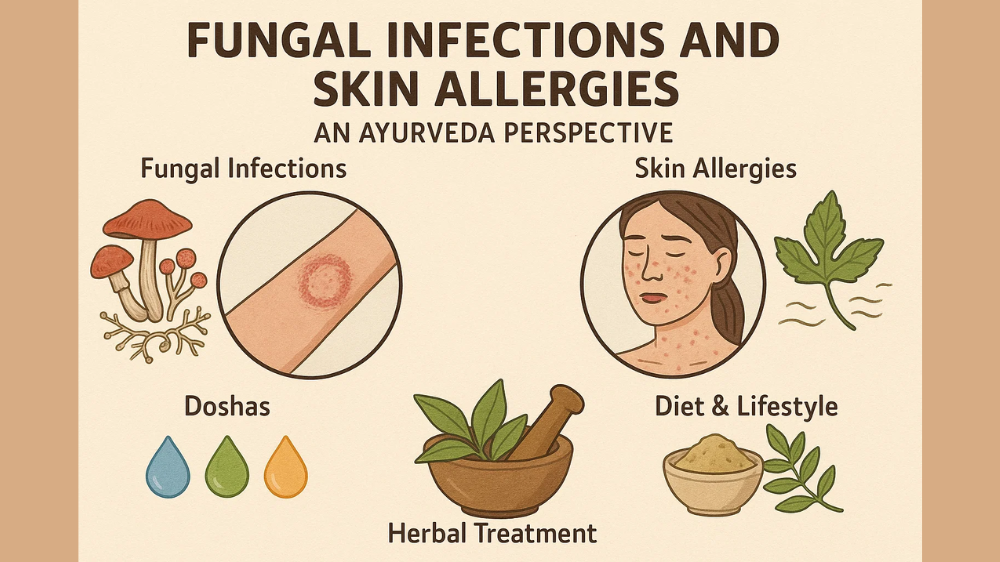 Fungal Infections and Skin Allergies An Ayurveda Perspective
