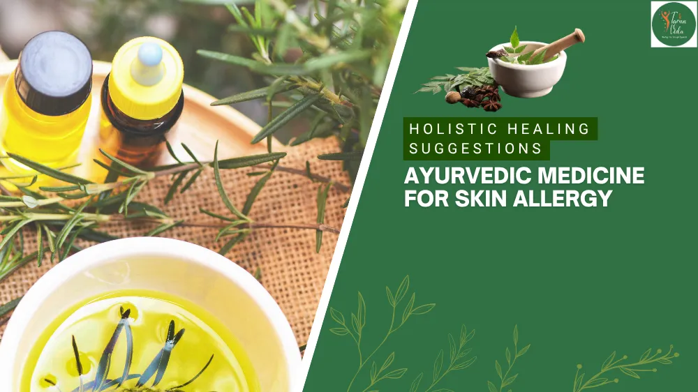 Ayurvedic Medicine for skin allergy